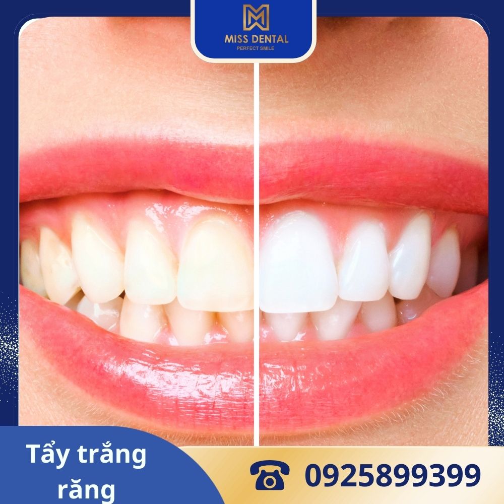 missdental.com.vn